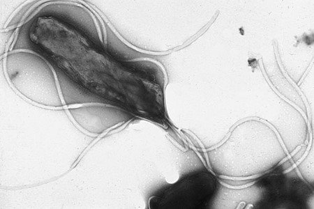 Figure 2. Electron micrograph of H. pylori. Source: Yutaka Tsutsumi | Wikimedia Commons