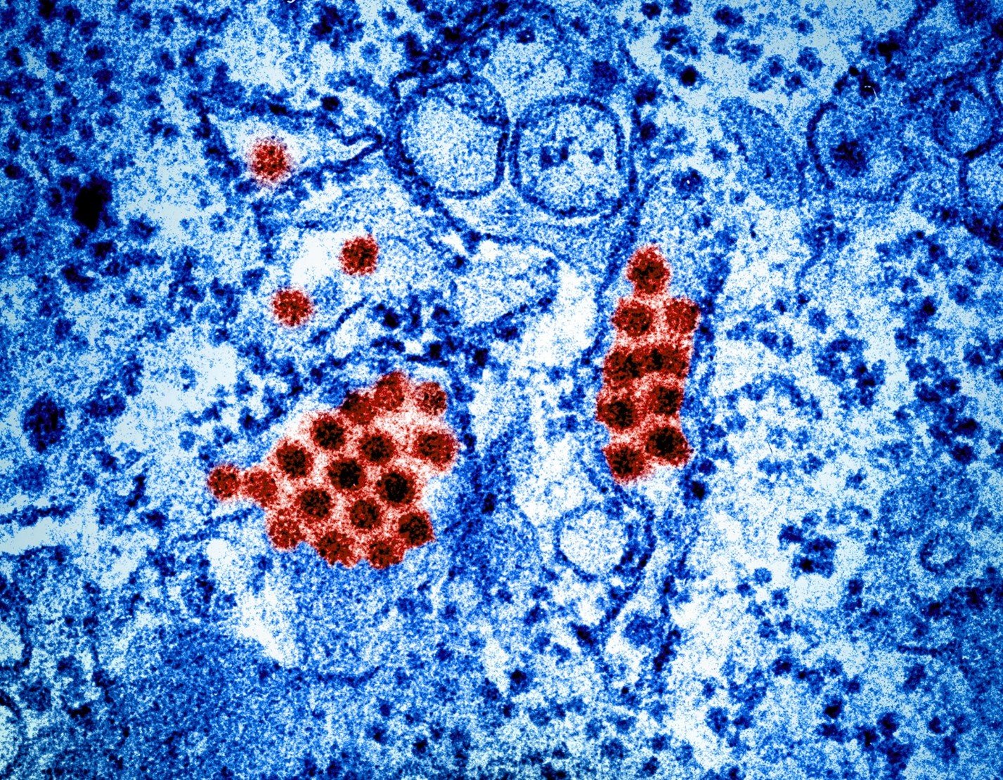 dengue virus particles