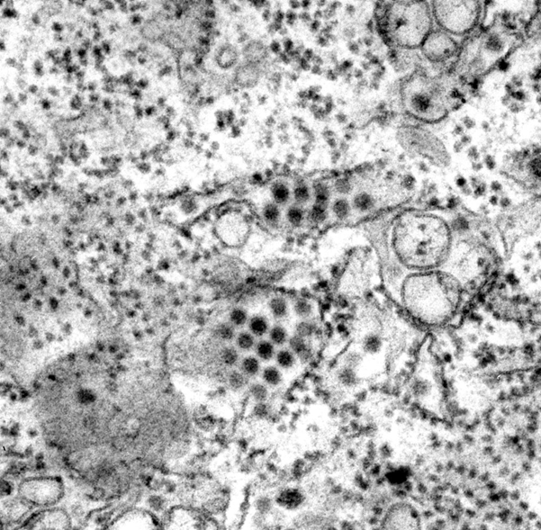 dengue virus particles