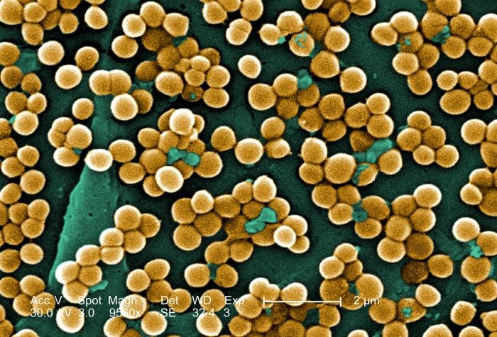 staphylococcus aureus