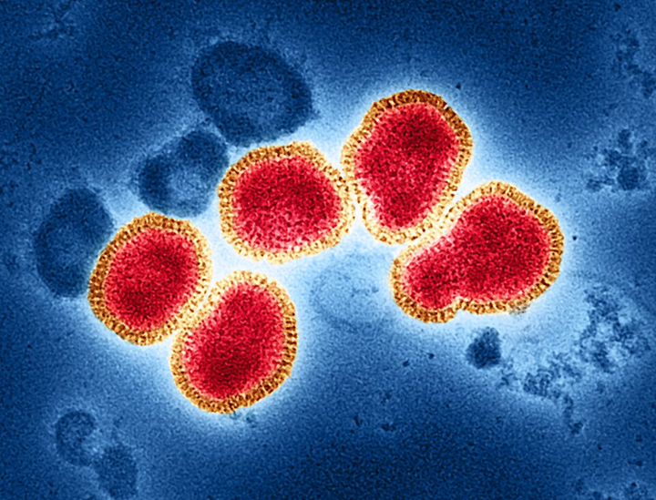 image of influenza virus